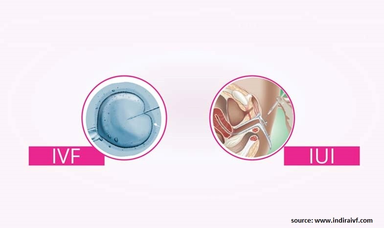 What’s the Difference Between IVF and IUI?