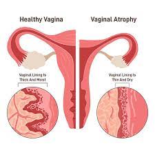 Seeking Medical Help: Diagnosis and Treatment Options